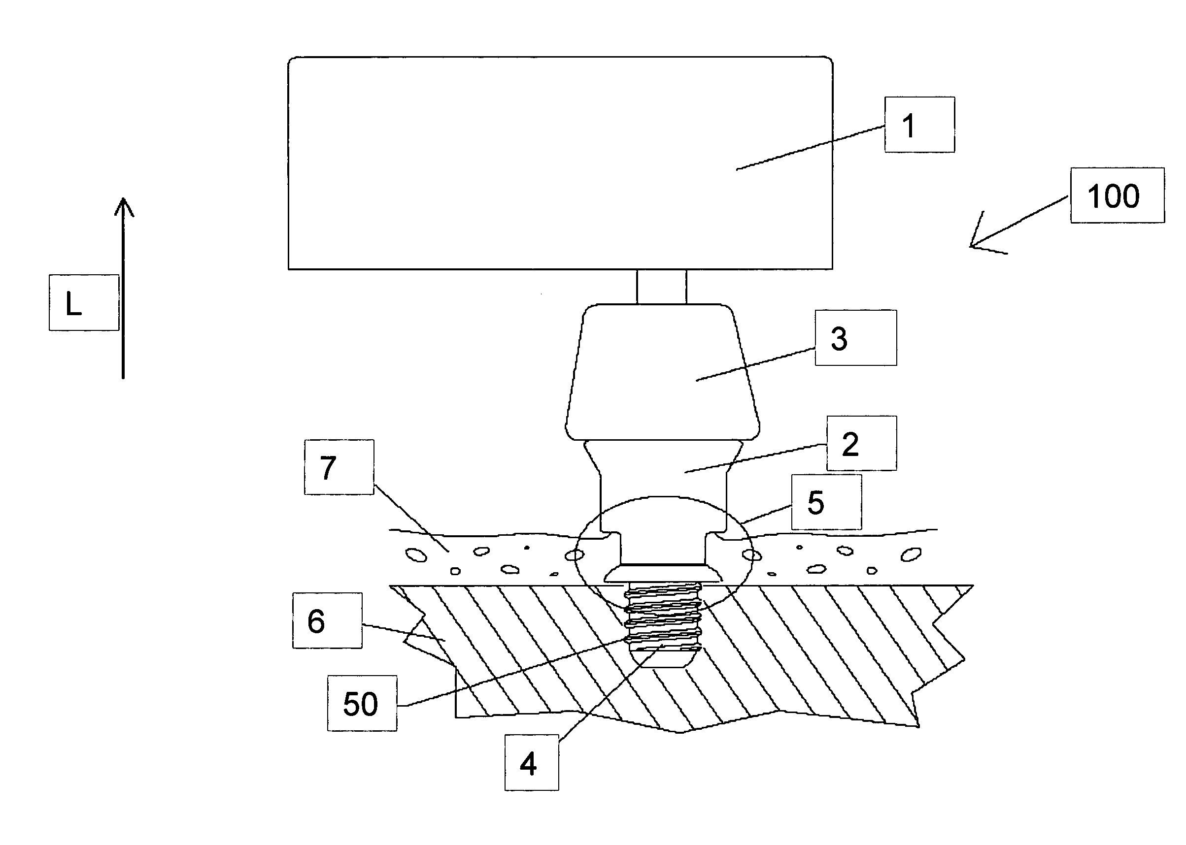 Hearing-aid interconnection system