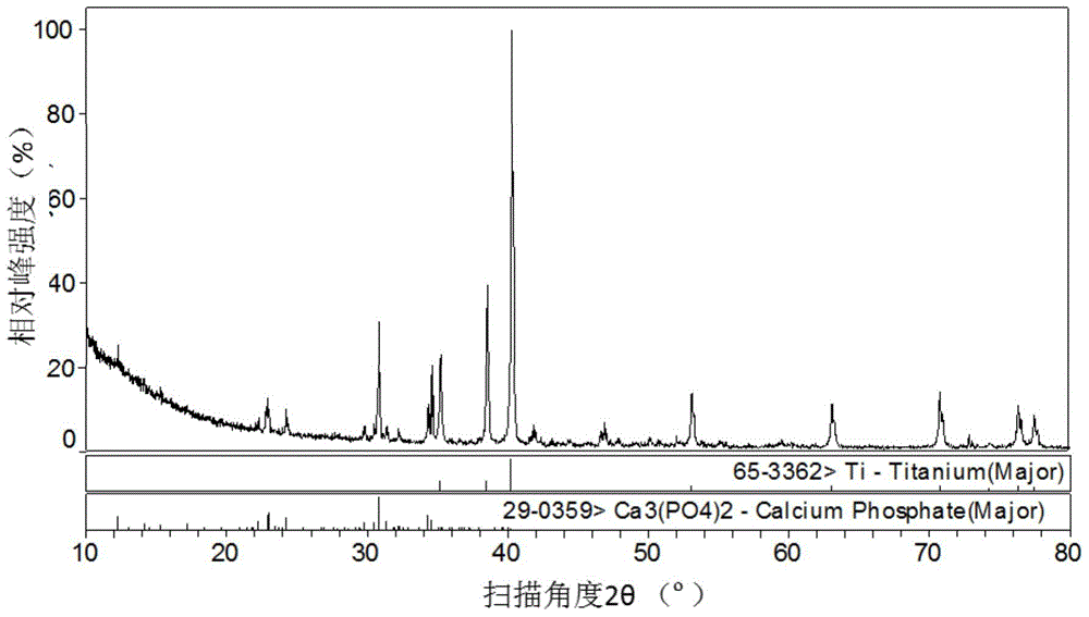 Titanium/tricalcium phosphate composite applied to bone implanting material and preparation method of titanium/tricalcium phosphate composite