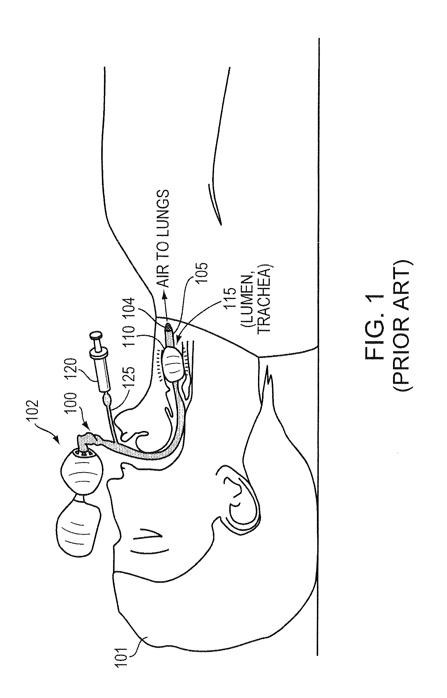 Methods and apparatus for safe application of an intubation device