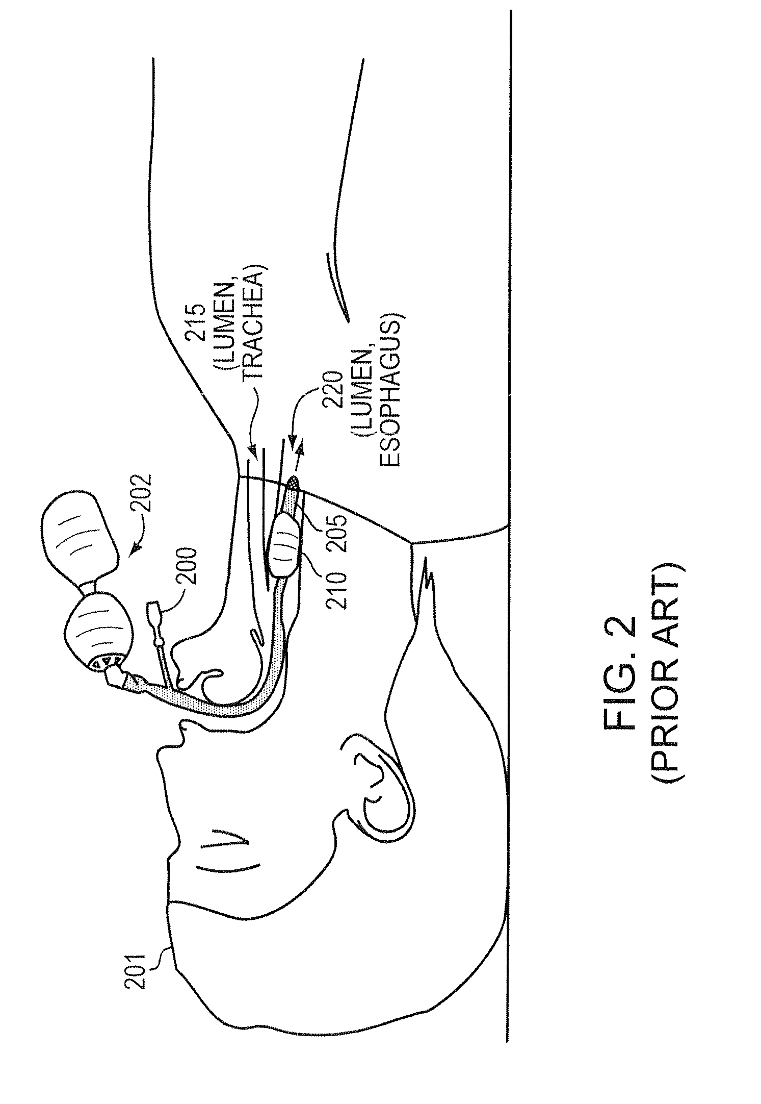 Methods and apparatus for safe application of an intubation device