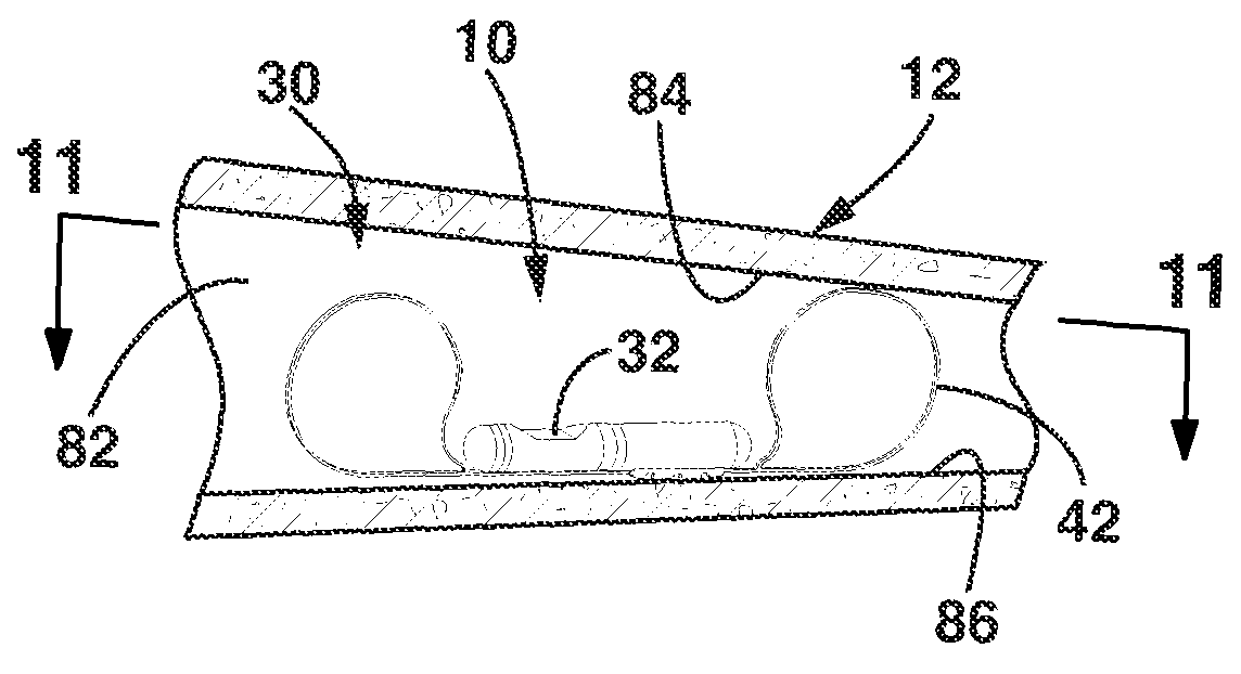 Implantable medical sensor and fixation system