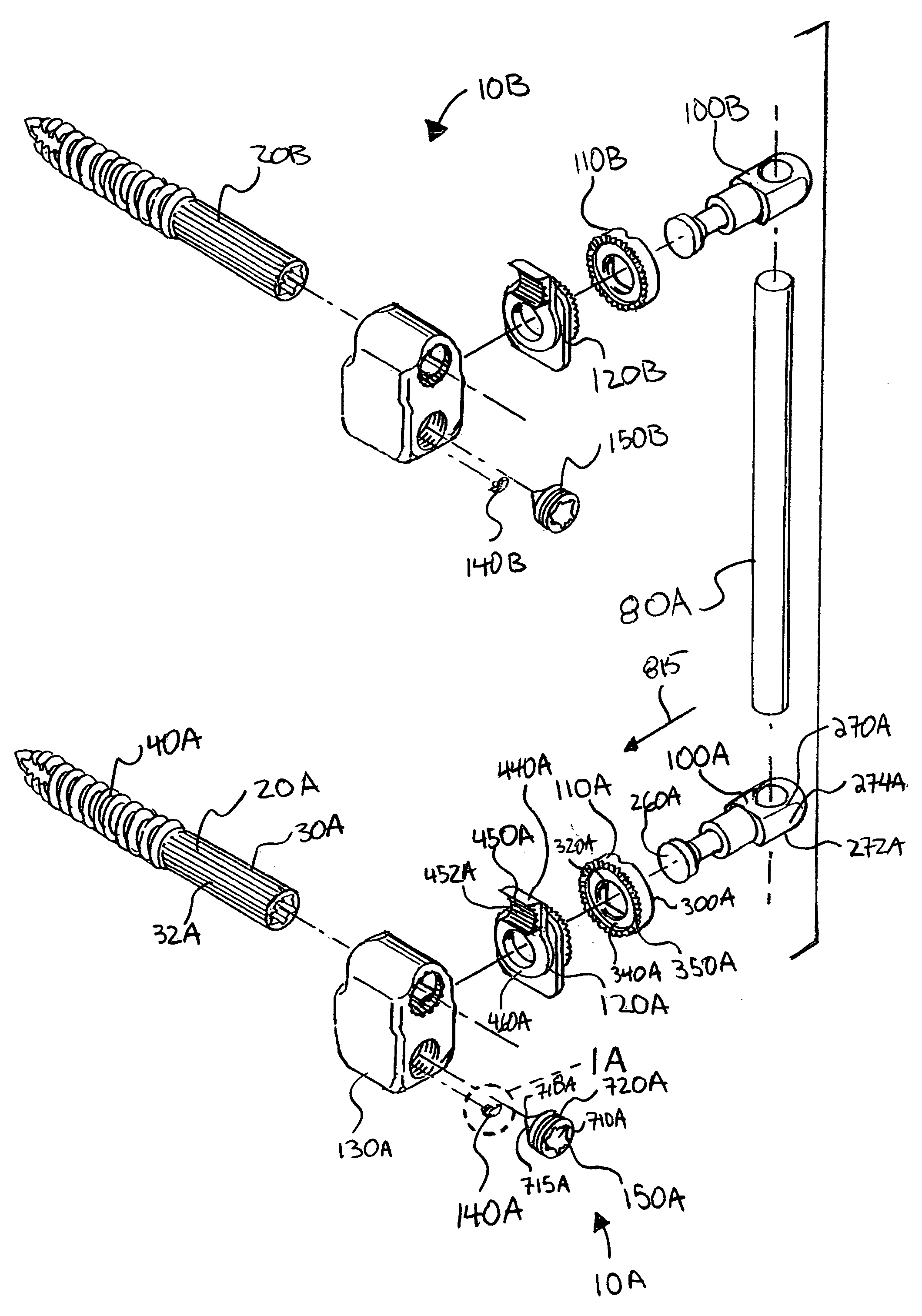 Bone fixation apparatus