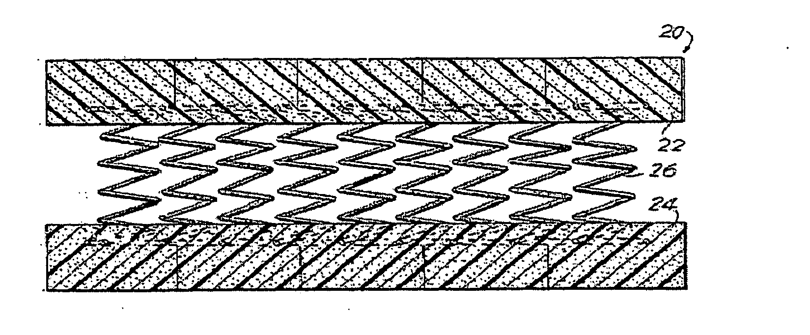 Multi-stranded coil spring