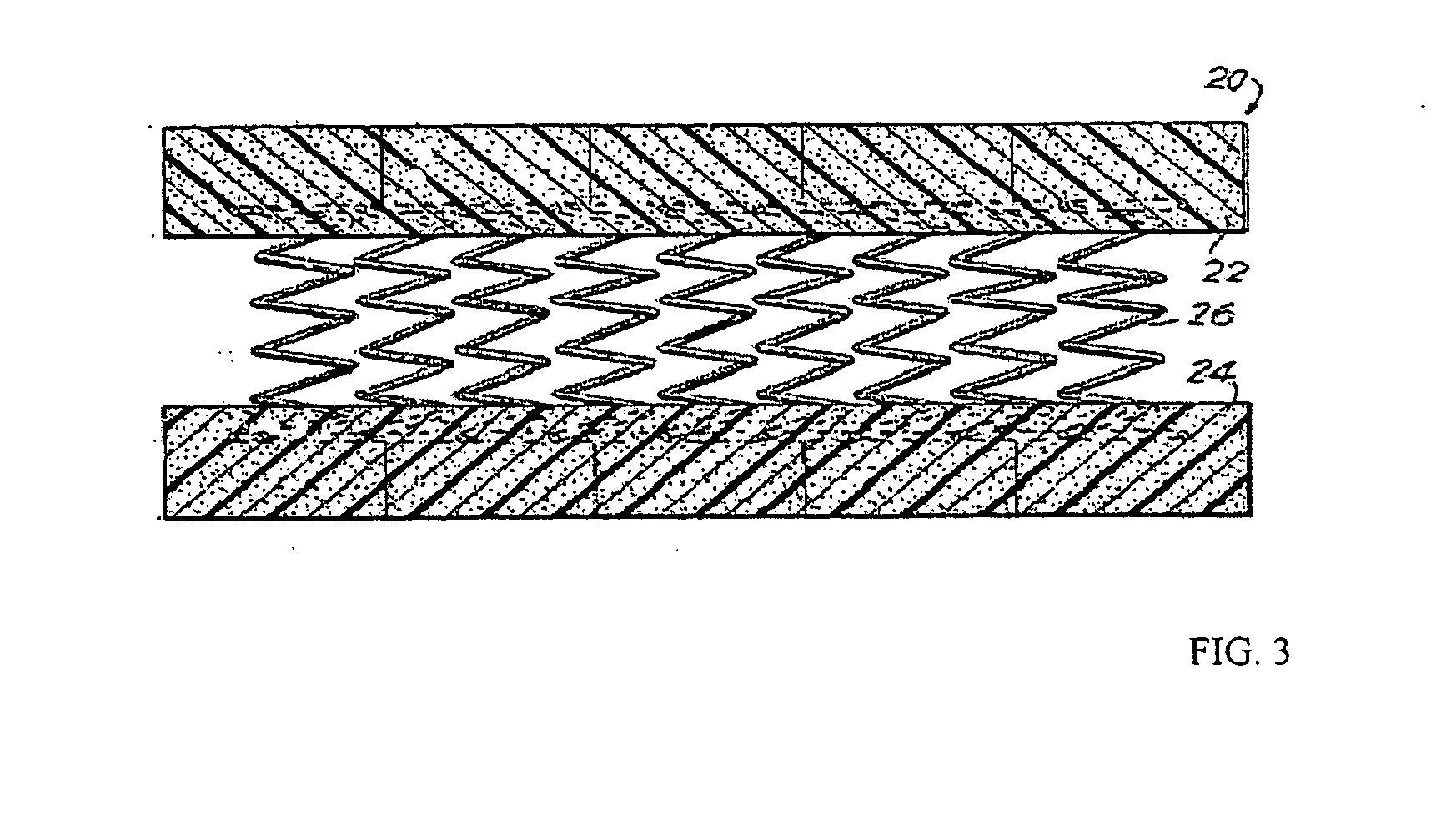 Multi-stranded coil spring