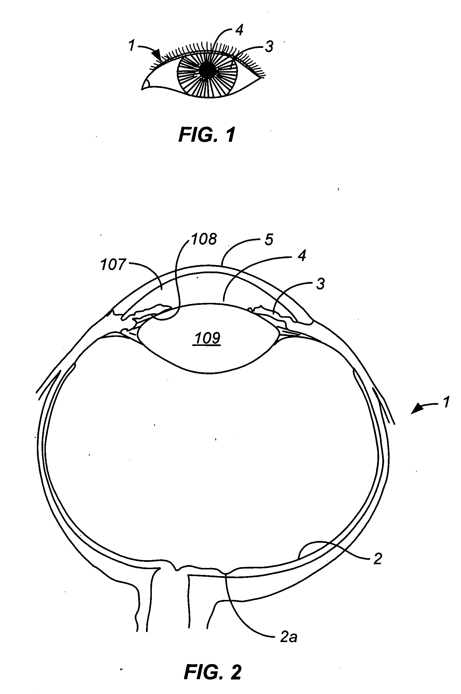 Intraocular lens measurement of blood glucose