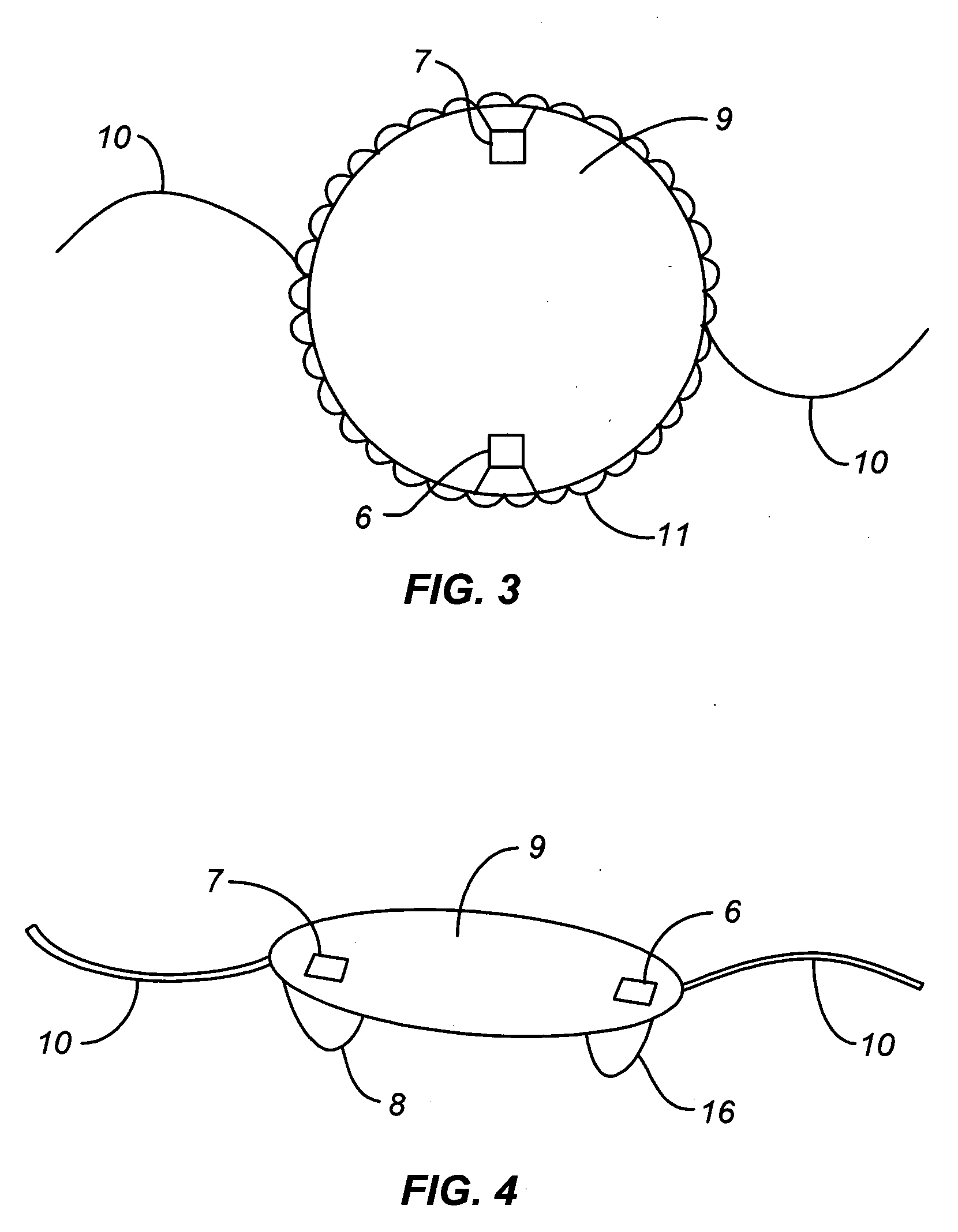 Intraocular lens measurement of blood glucose