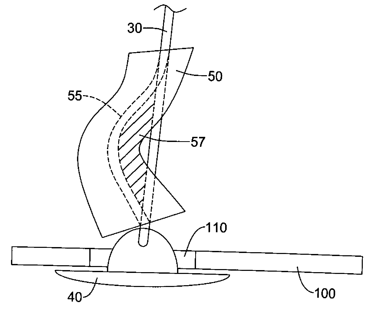 Plug for arteriotomy closure and method of use