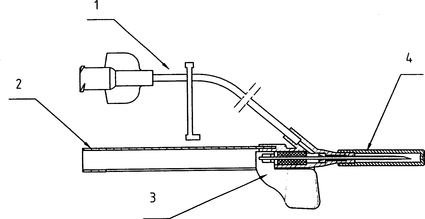 Safety indwelled needle with wings for venous transfusion