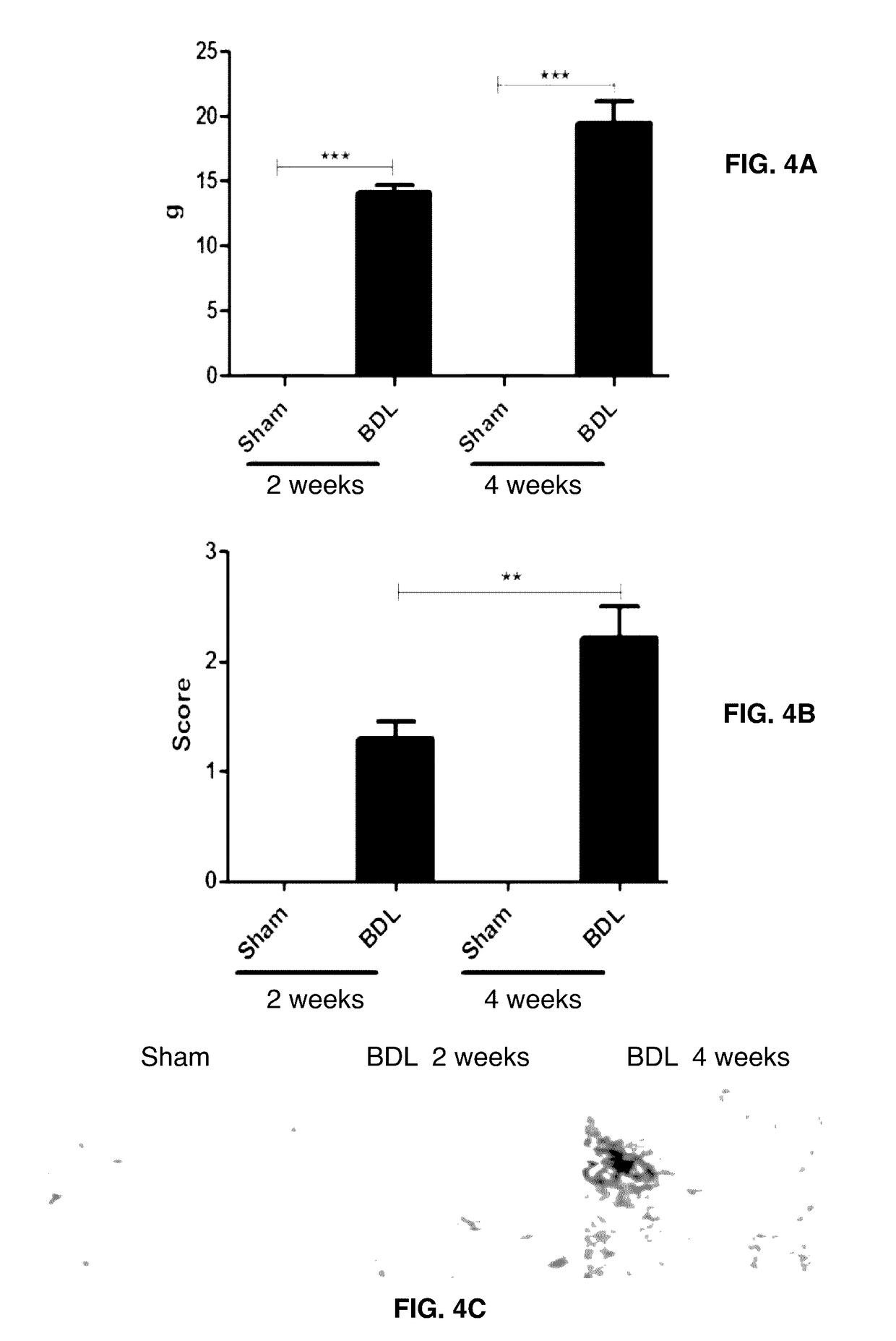 Fibrosis biomarker assay