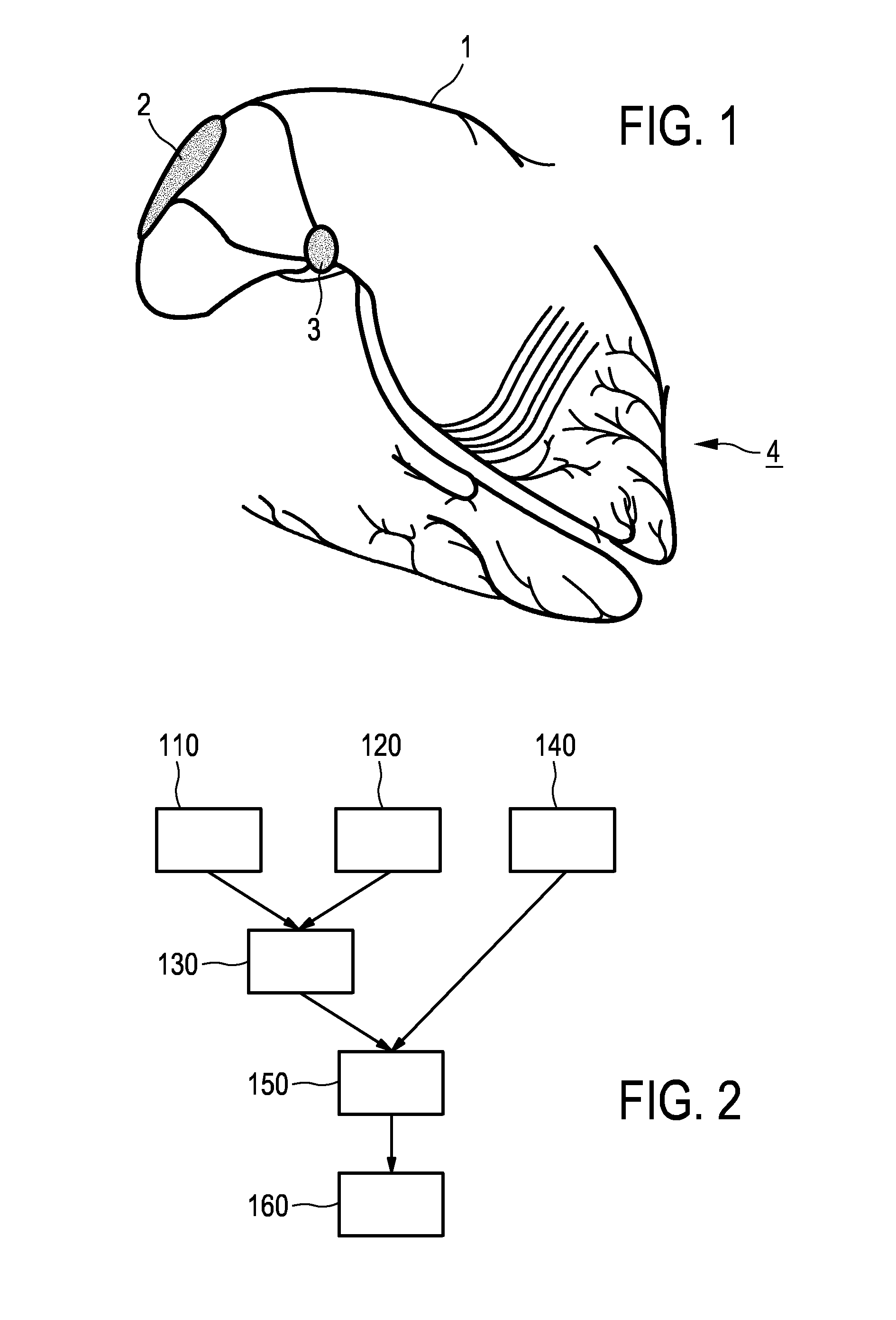 Apparatus and method for visualizing a conduction tract of heart