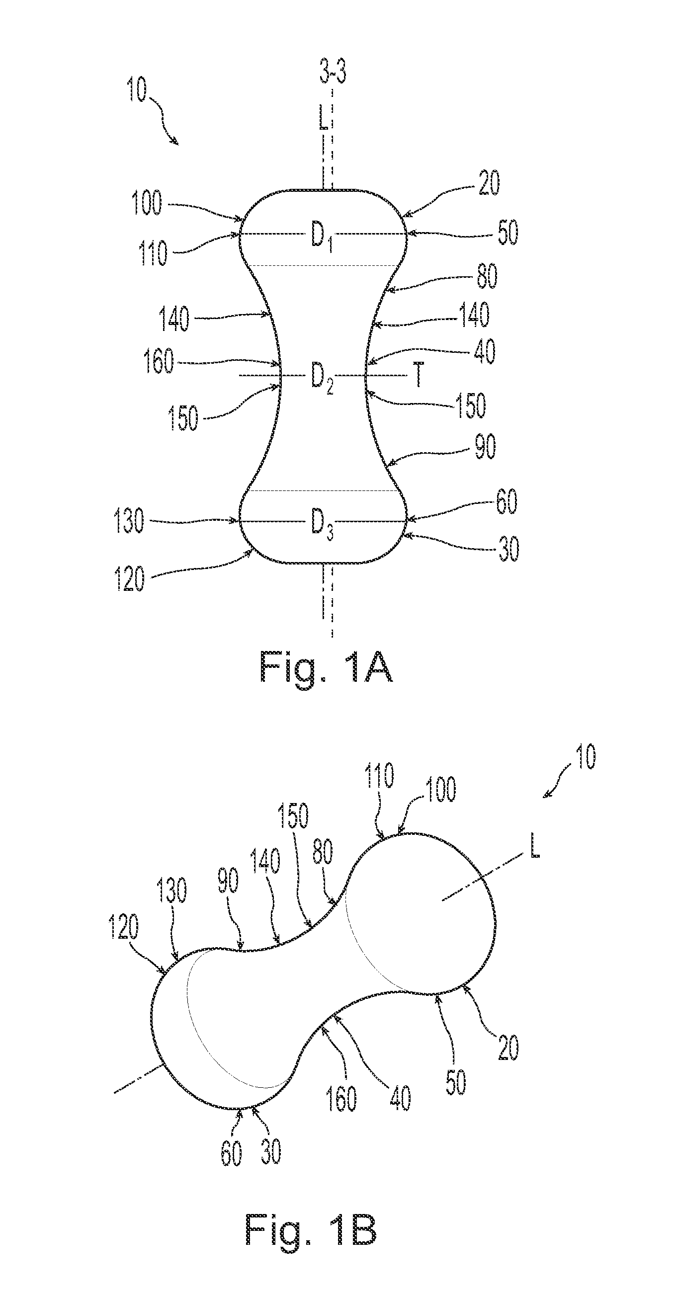 Method for treating urinary incontinence