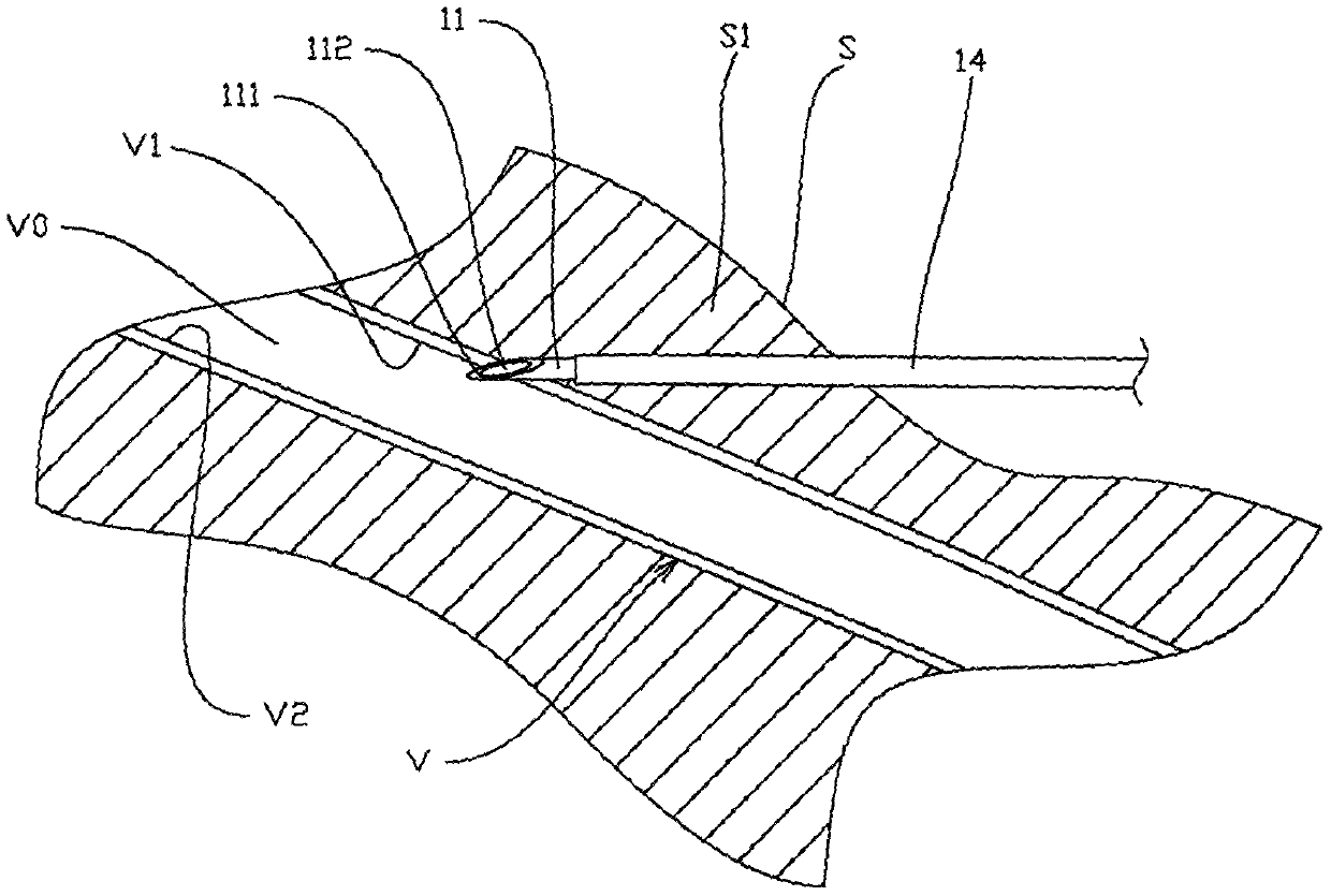 A kind of safe venous indwelling needle