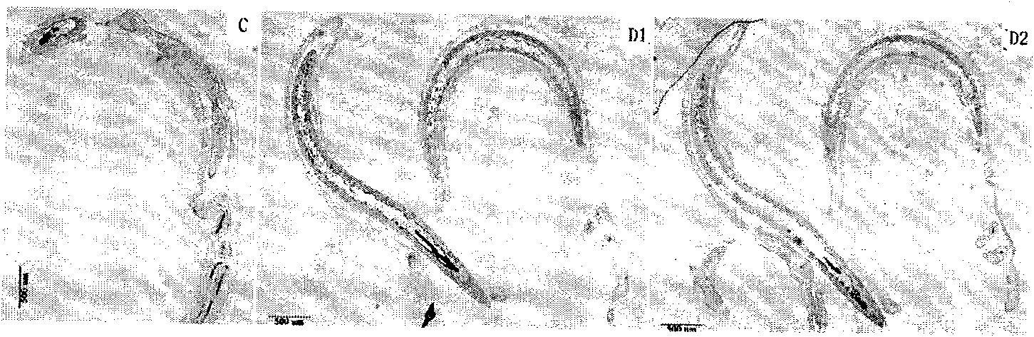 Worm body membrane bound short peptide ZL-4 with specific target and anti-schistosome function and application thereof