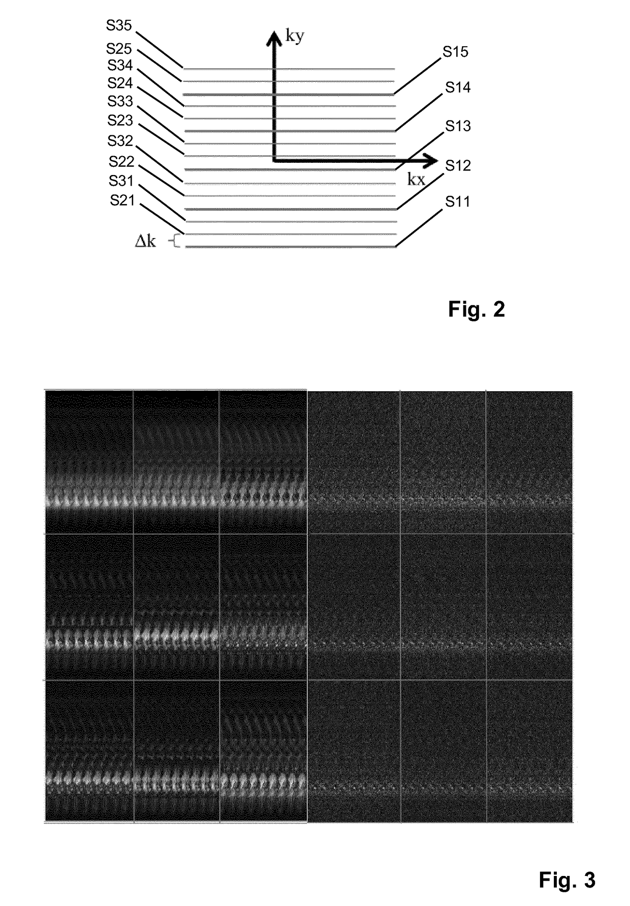 Mr imaging with motion detection