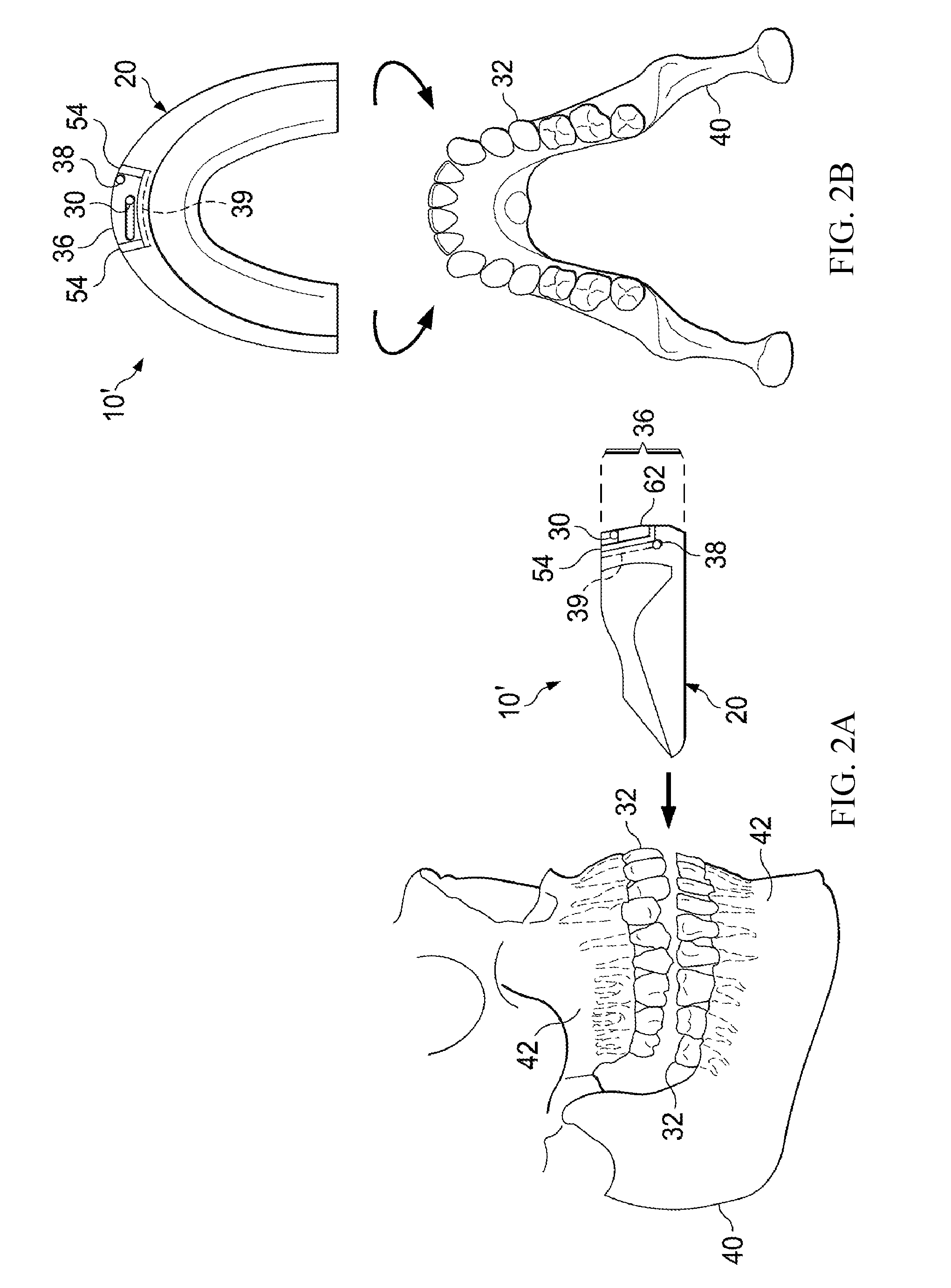 Pulsatile orthodontic device and methods