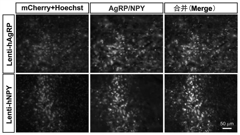 Vectors and reagent for constructing hNPY and hAgRP gene overexpression chimeric animal model and application