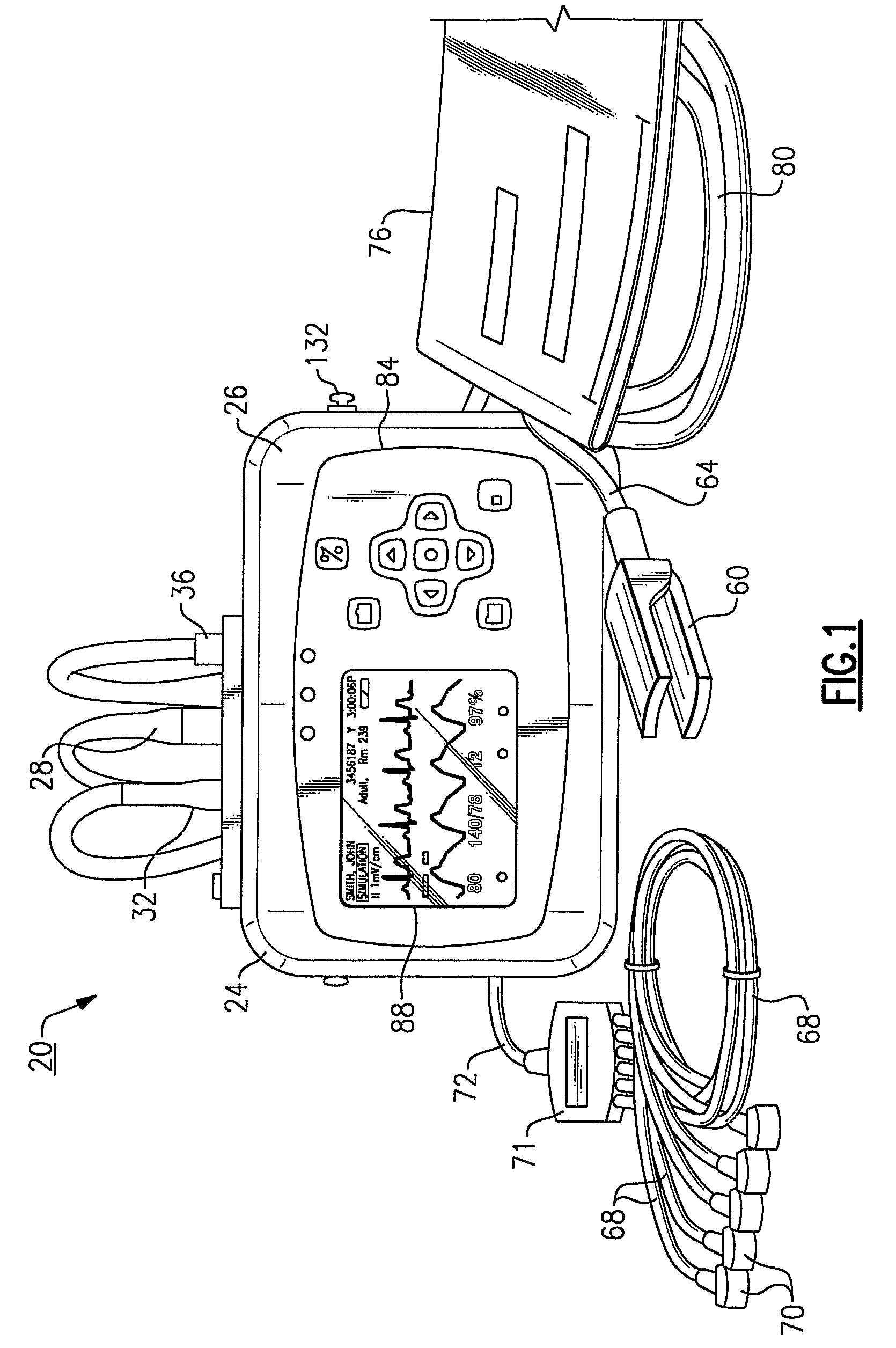 Vital signs monitor