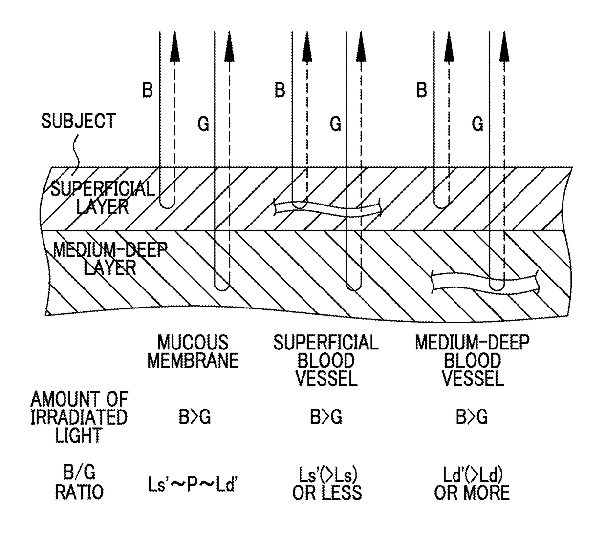 Endoscope system, processor device of endoscope system, and image processing method