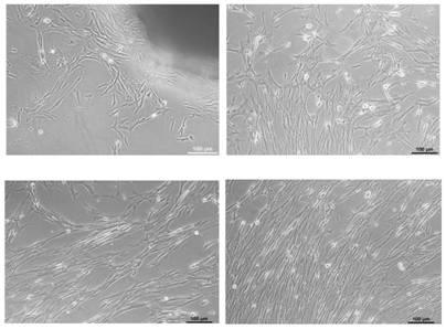 In-vitro culture, identification and induced differentiation method of sebastes schlegeli myoblasts