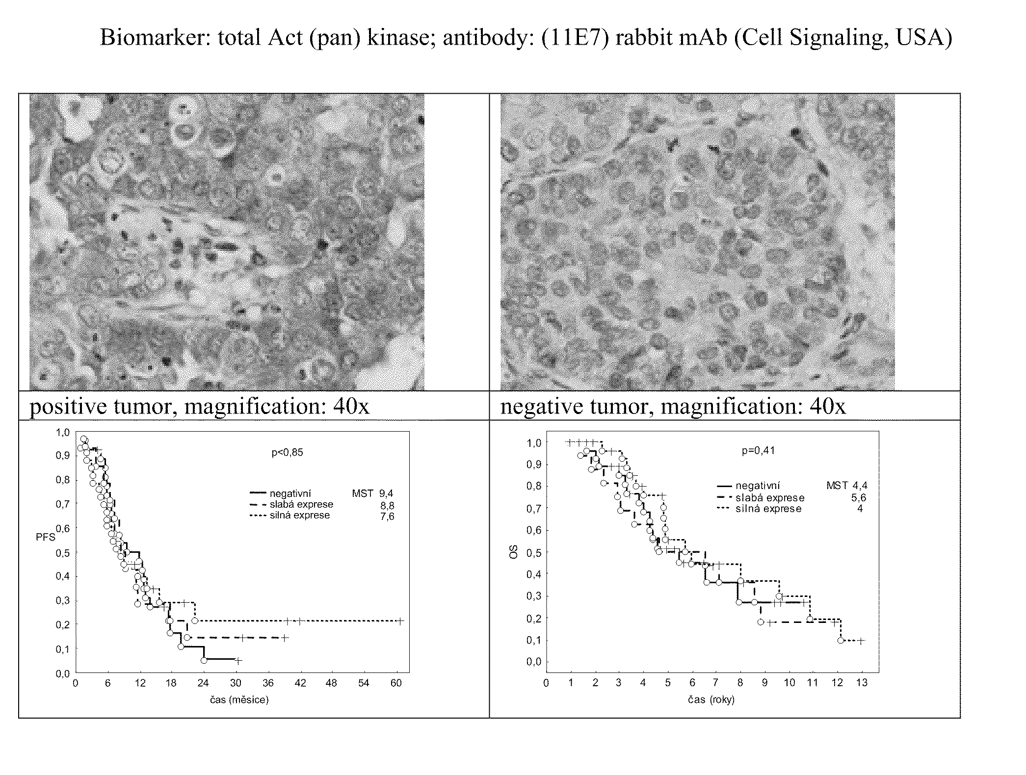 Method For Determining The Sensitivity Of Patients Suffering From A Cancer Disease To Biological Therapy