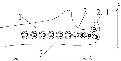 A ruler eagle mouth format lock method and steel plate structure