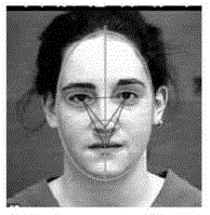 Accurate positioning of facial acupoints and learning method of acupuncture and moxibustion prescription