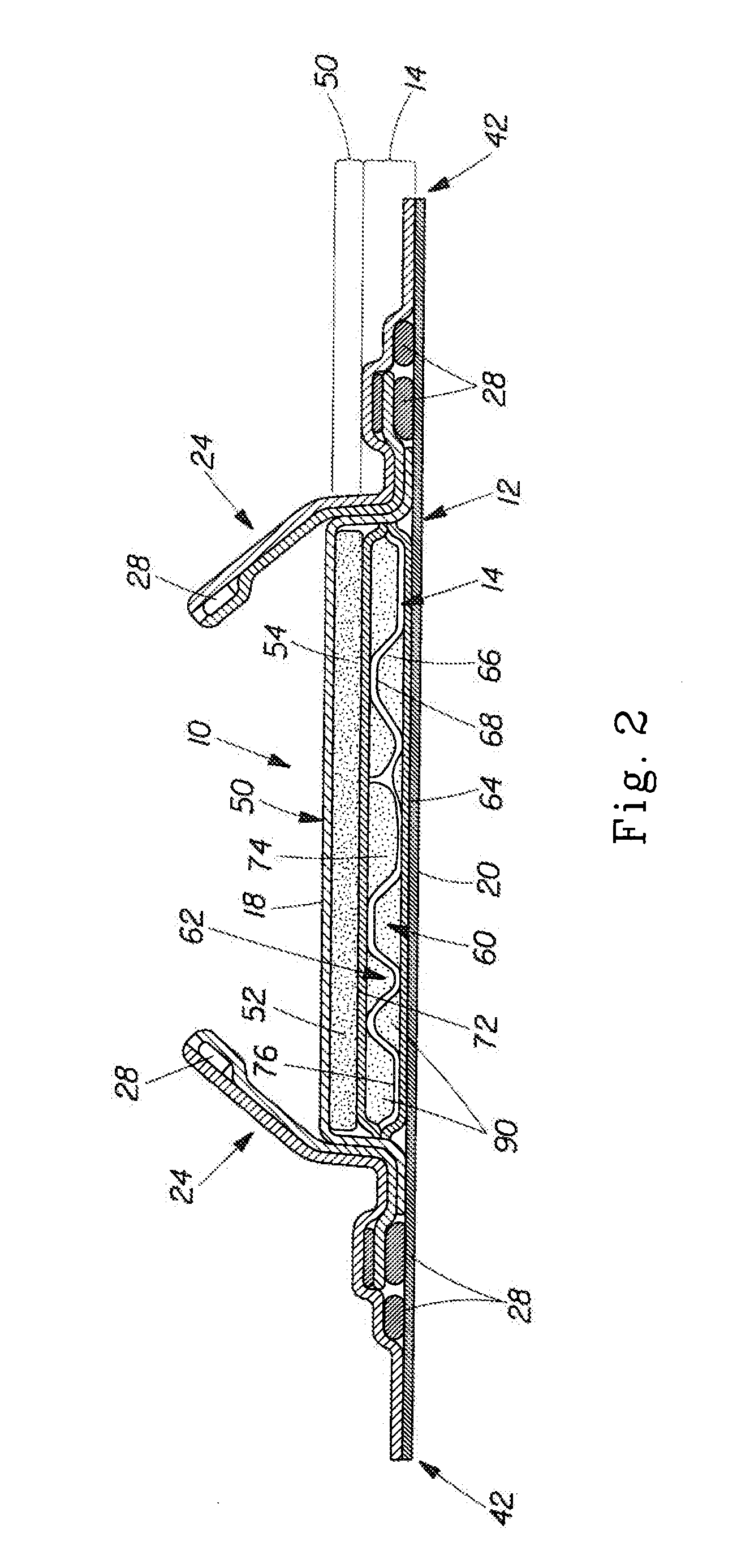 Disposable Absorbent Article With Improved Acquisition System