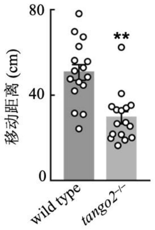 Zebra fish model for metabolic encephalopathy and arrhythmia diseases and application of zebra fish model