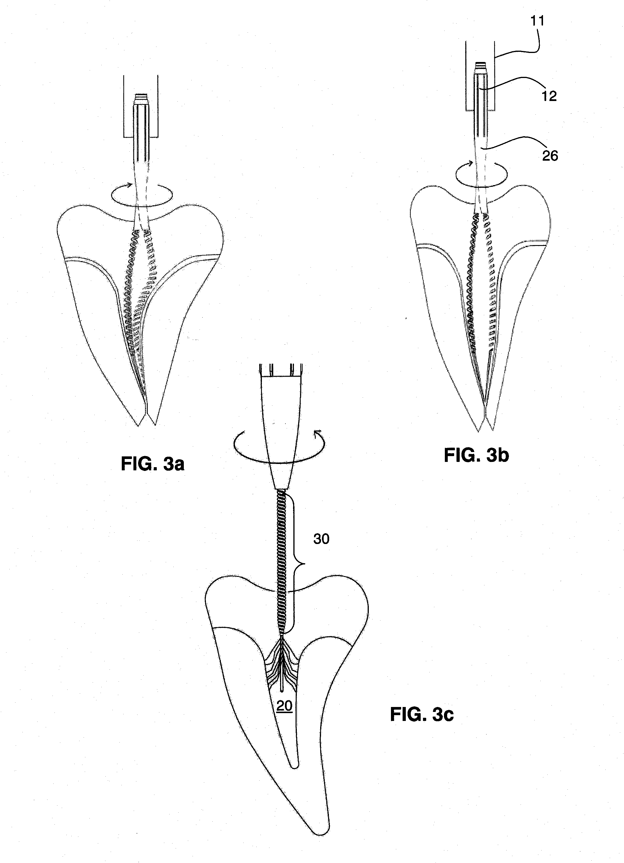 Endodontic file