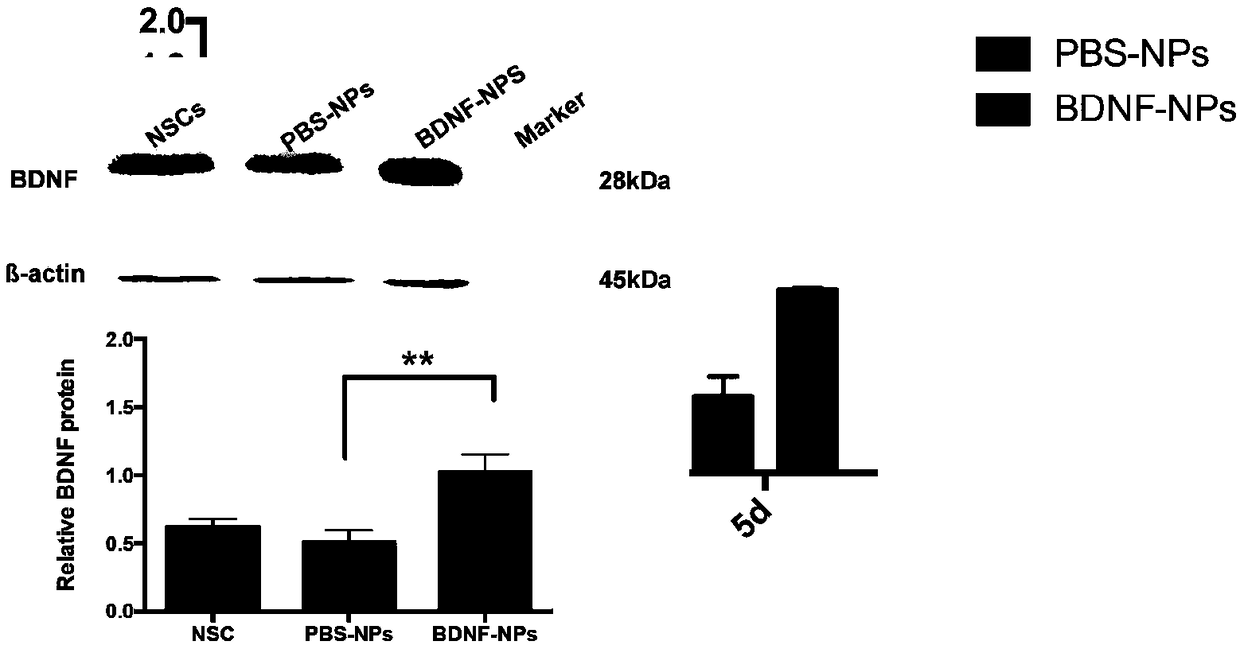 PEG-PLGA nanosphere loading BDNF gene plasmid as well as preparation method and application thereof