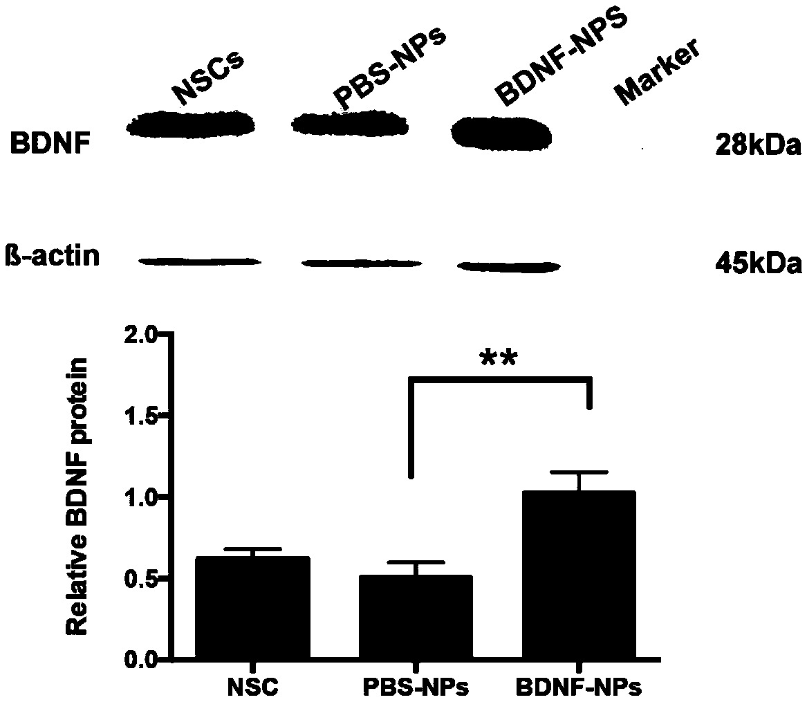 PEG-PLGA nanosphere loading BDNF gene plasmid as well as preparation method and application thereof