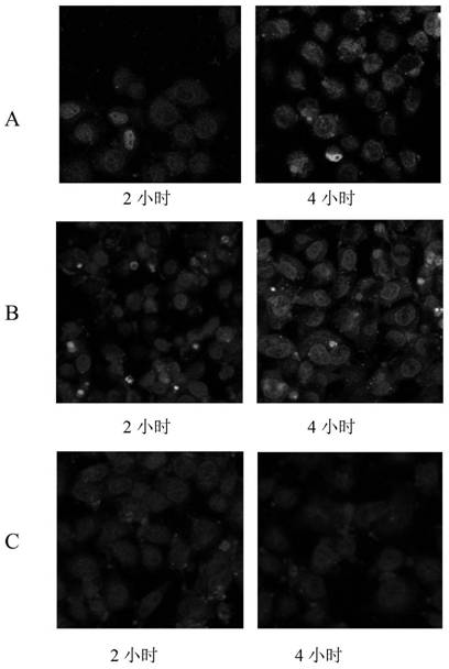 Tumor-specific cleavable pegized nanoparticles, preparation method and application
