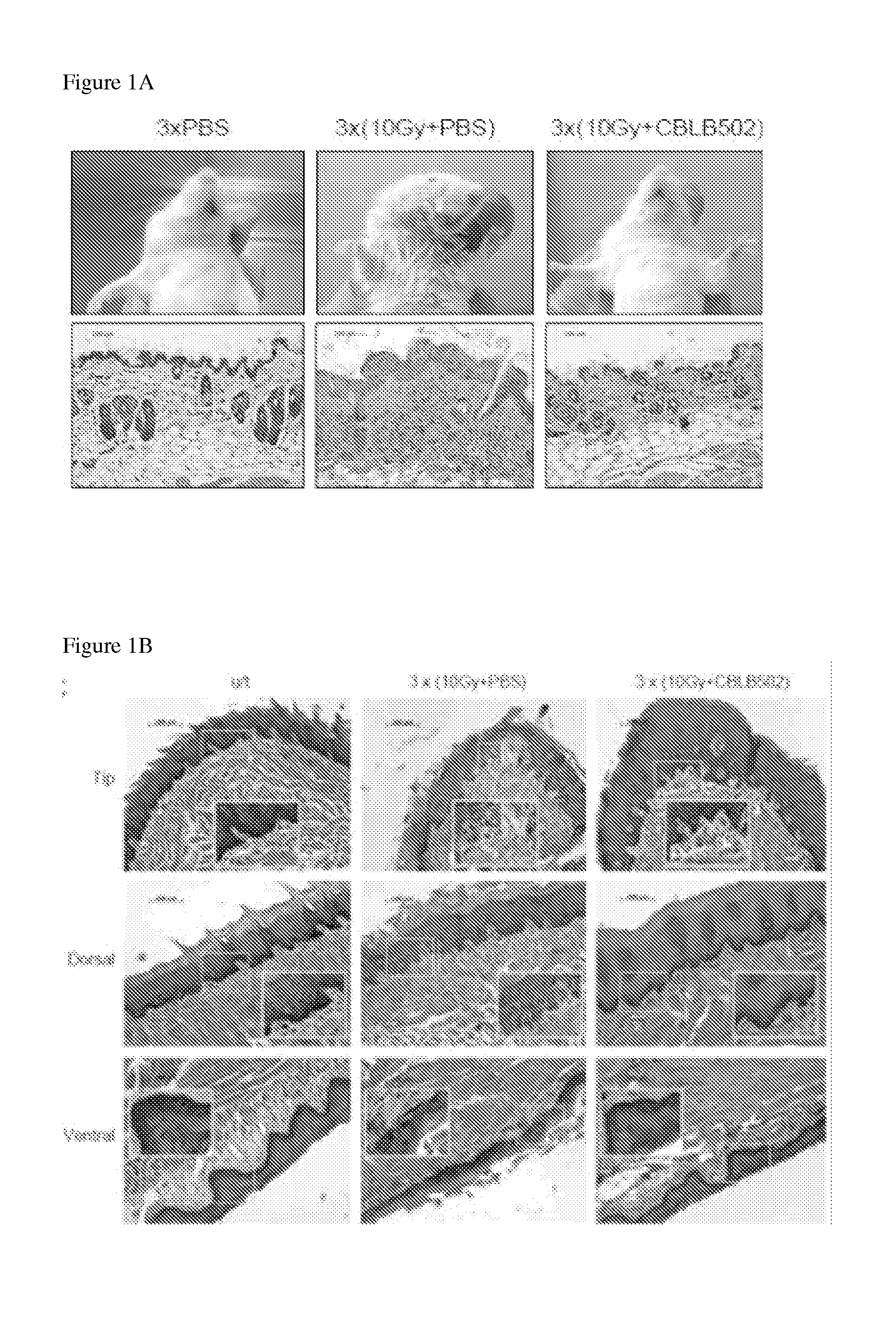 Compositions and methods comprising toll like receptor (TLR) stimulating agents for prophylaxis and therapy for damage to dermal epithelium