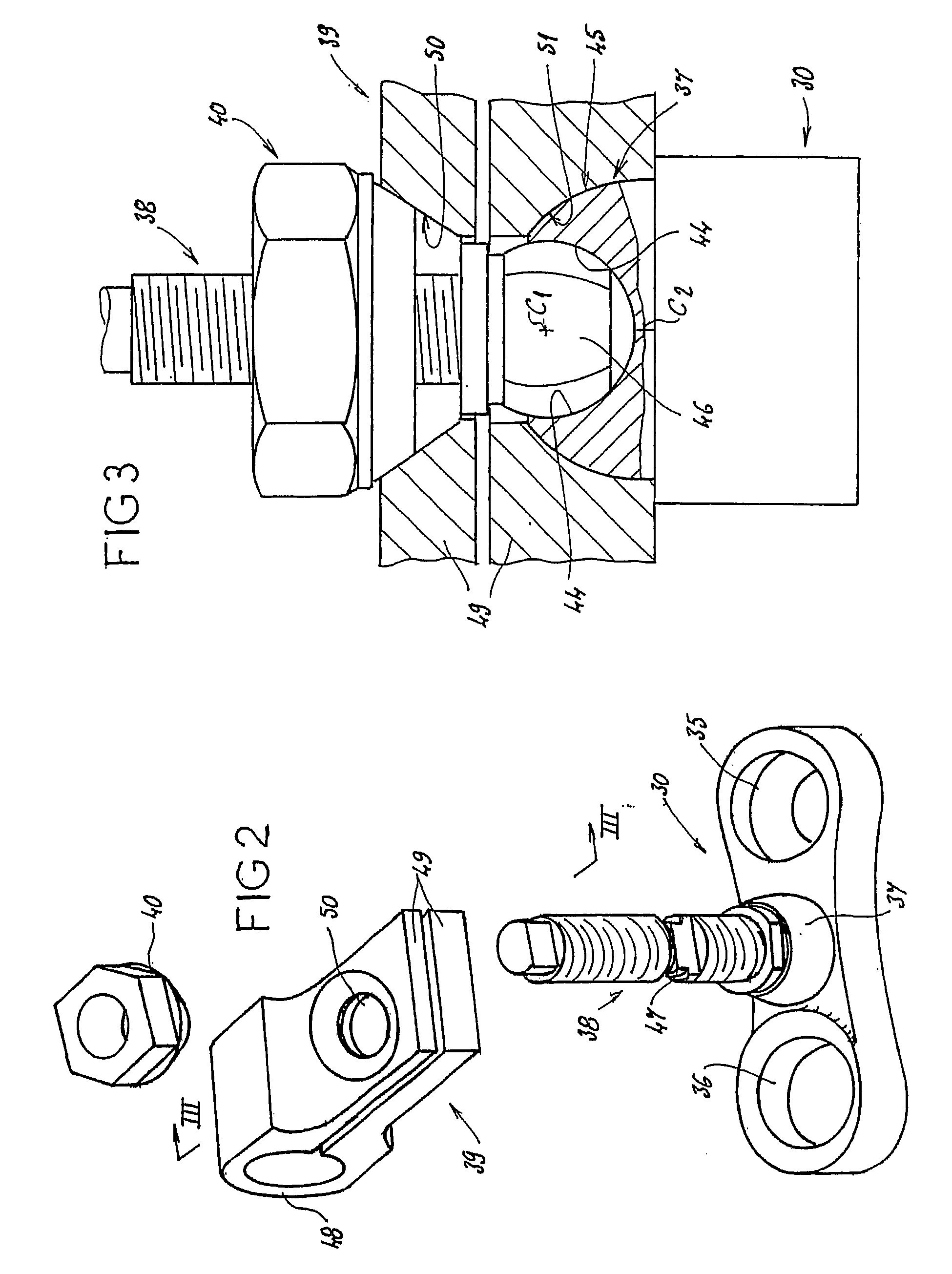 Vertebral arthrodesis equipment