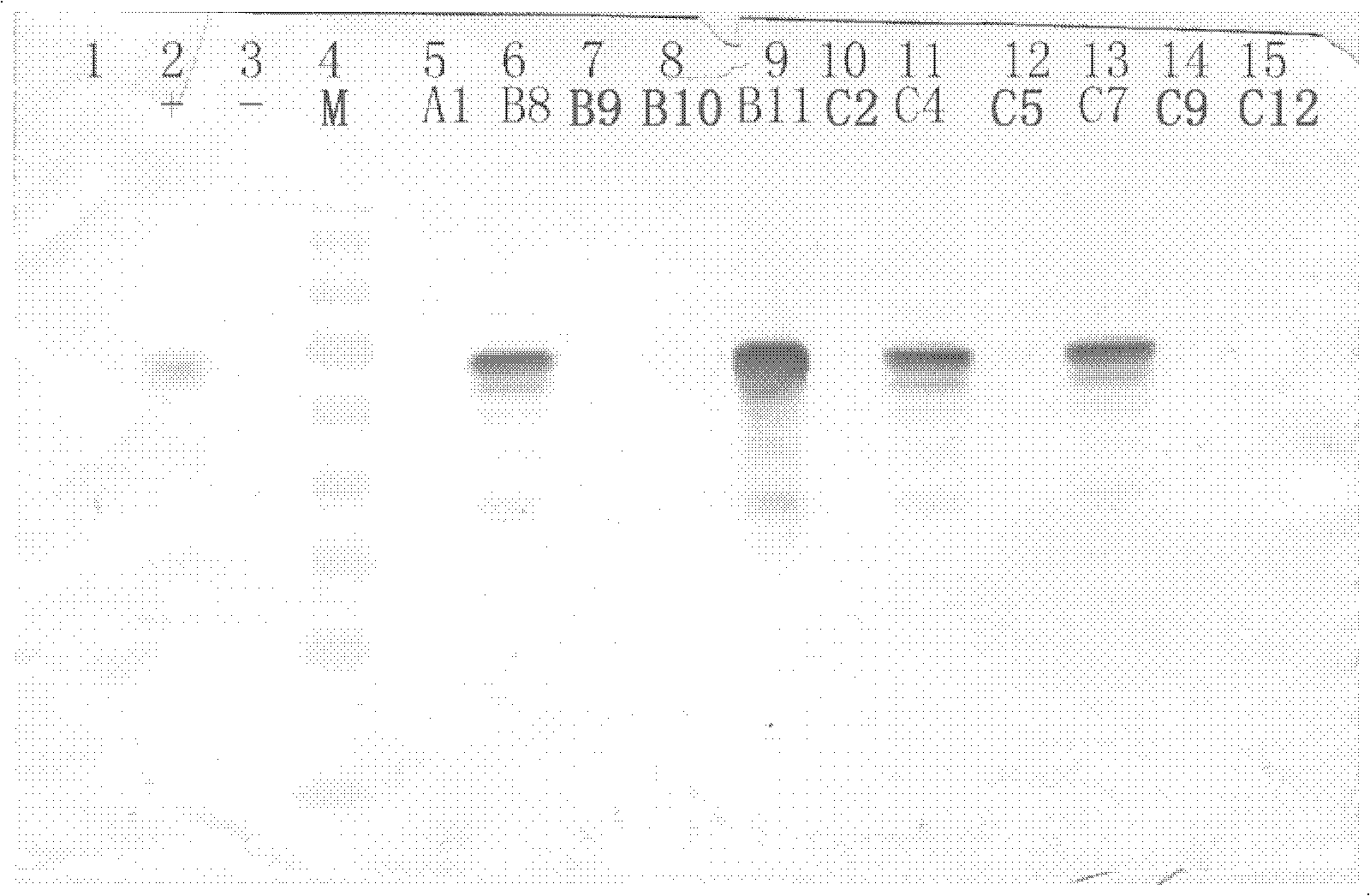 Dengue virus and Japanese encephalitis virus embedded pseudo virus particle vaccine and preparation method thereof