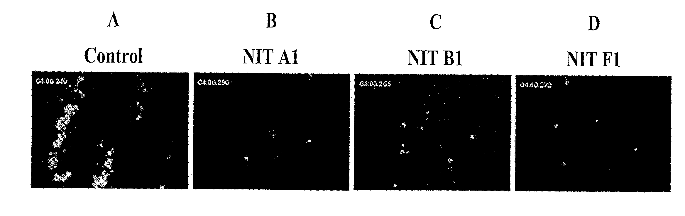 ANTIBODIES AGAINST GPIb alpha