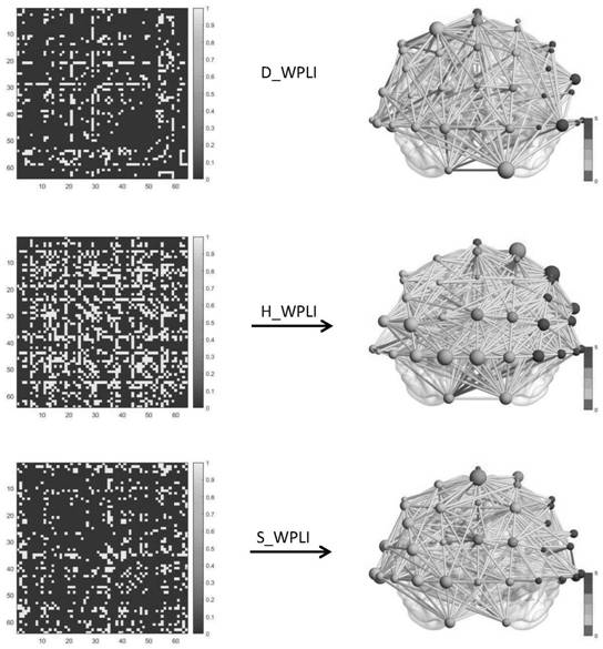 Depression and bipolar disorder brain network analysis method based on dual-channel phase synchronization feature fusion