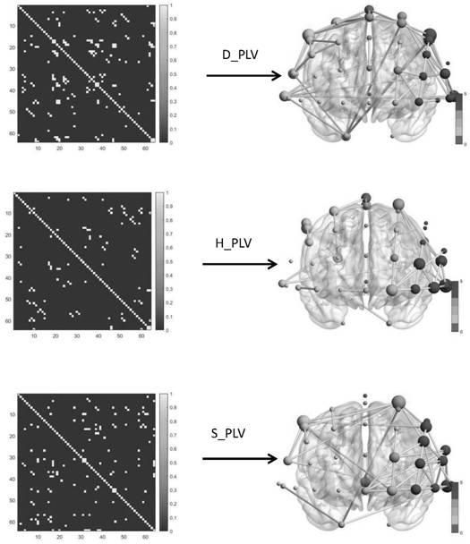 Depression and bipolar disorder brain network analysis method based on dual-channel phase synchronization feature fusion