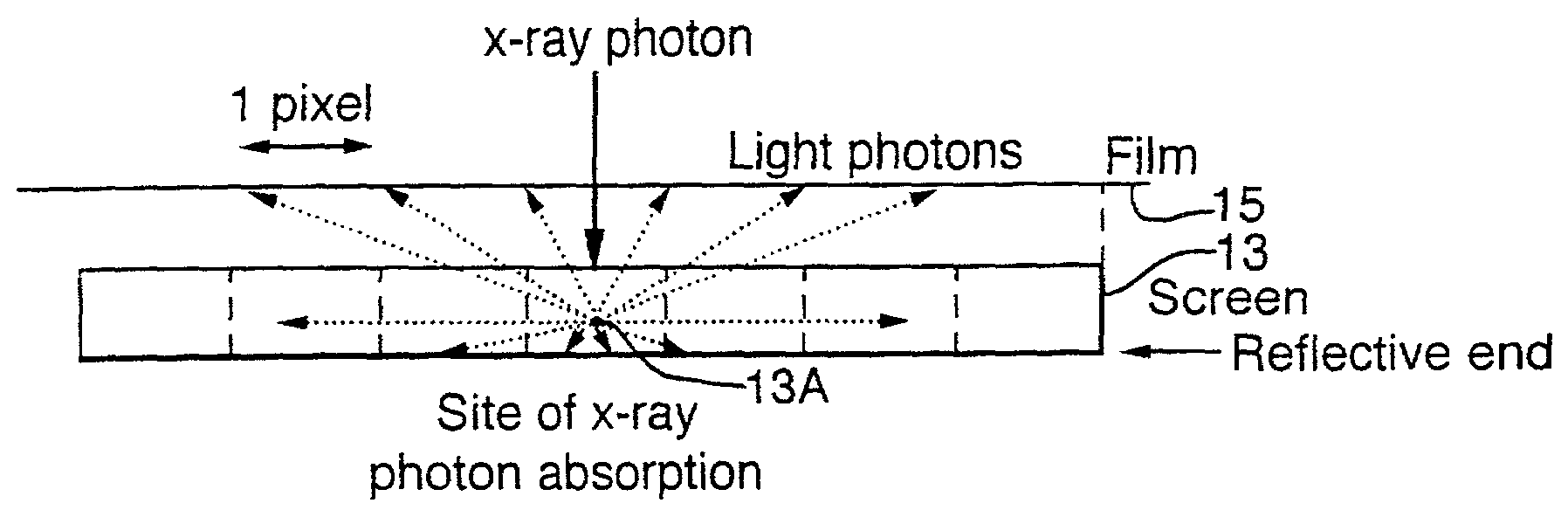 X-ray image processing