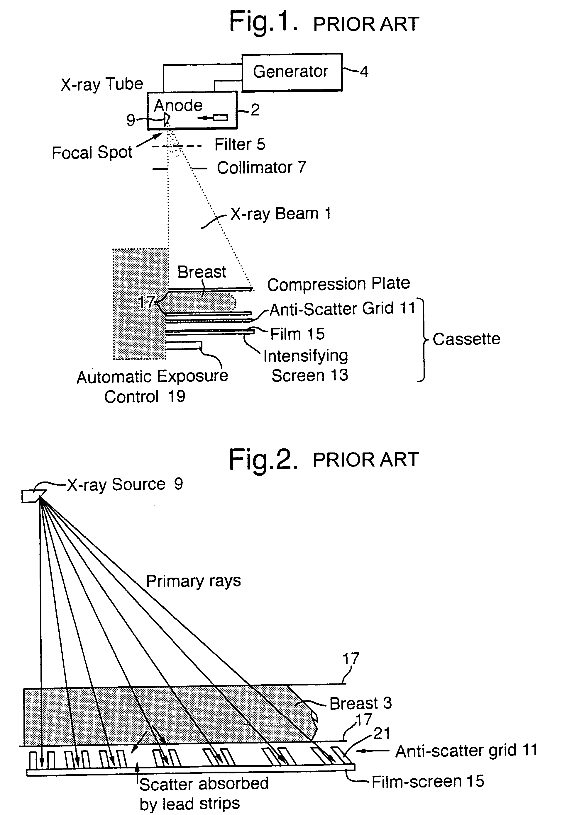 X-ray image processing