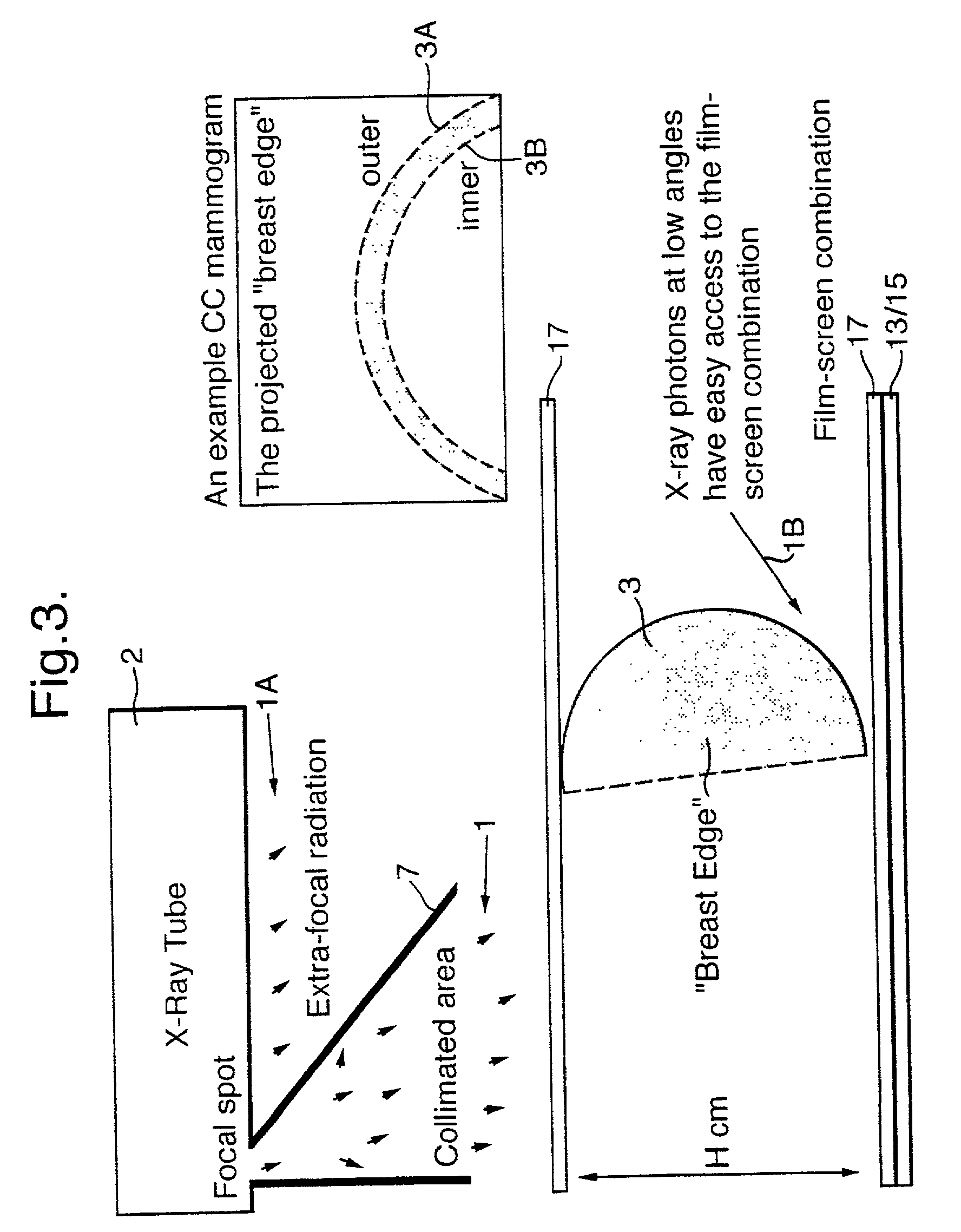 X-ray image processing