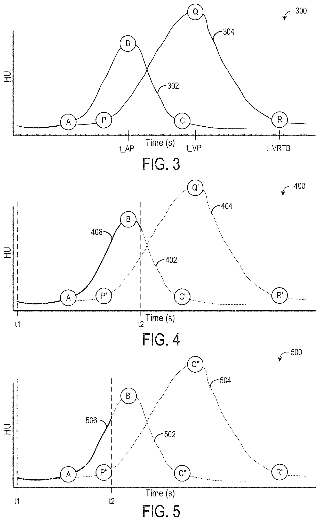 Methods and systems for an adaptive multi-zone perfusion scan