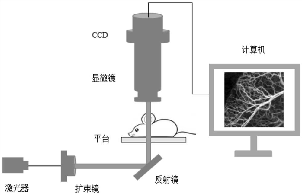 Blood flow dynamic detection method and system based on laser speckle imaging and medium