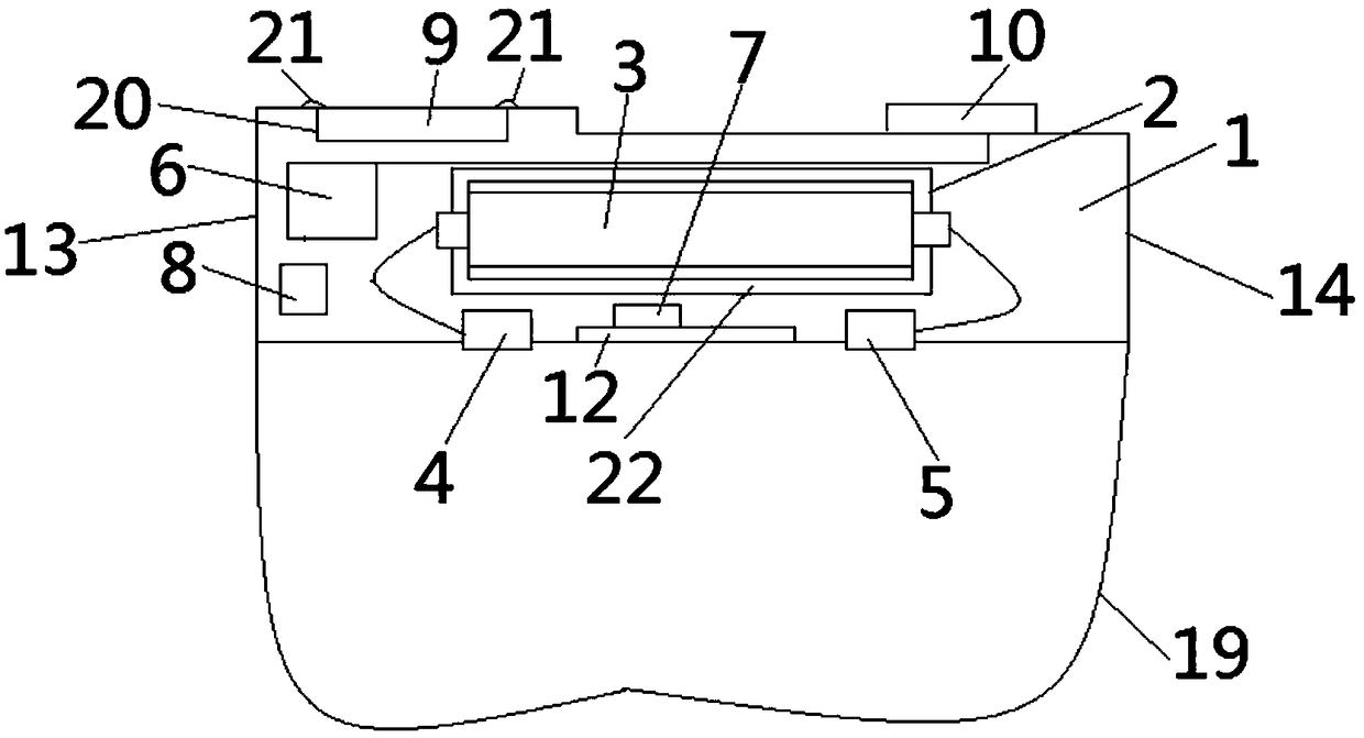 Noninvasive intelligent detector for diabetes