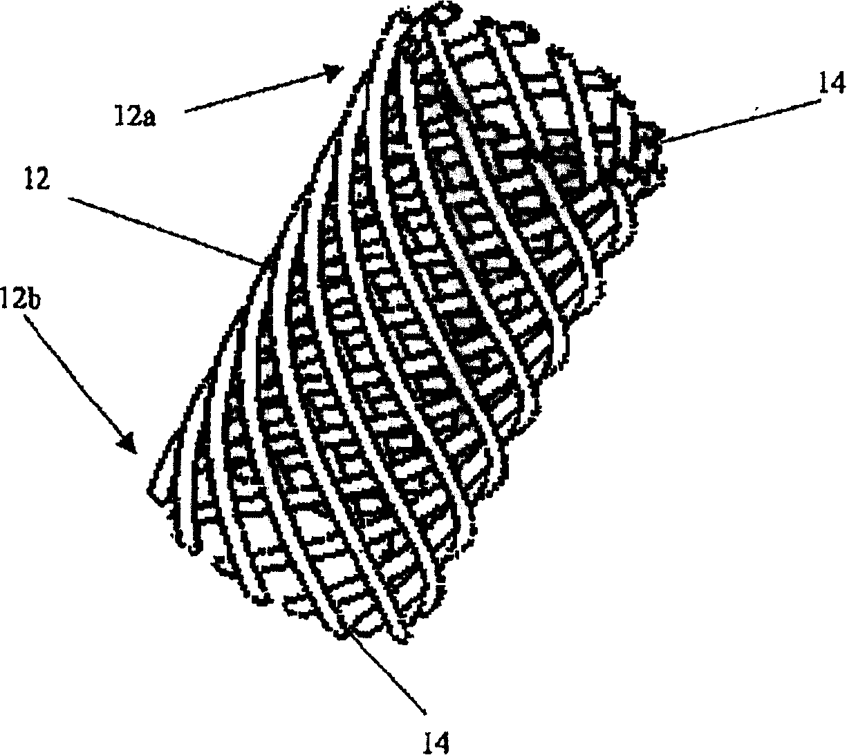 Built-in stomach limitation device