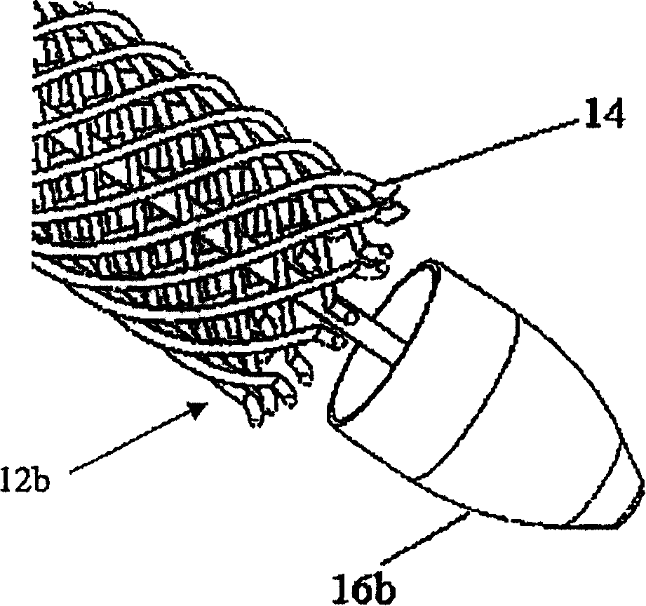 Built-in stomach limitation device