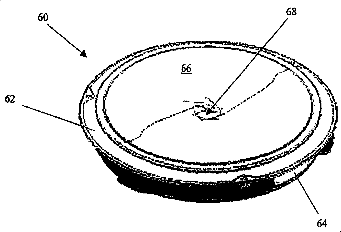 Built-in stomach limitation device