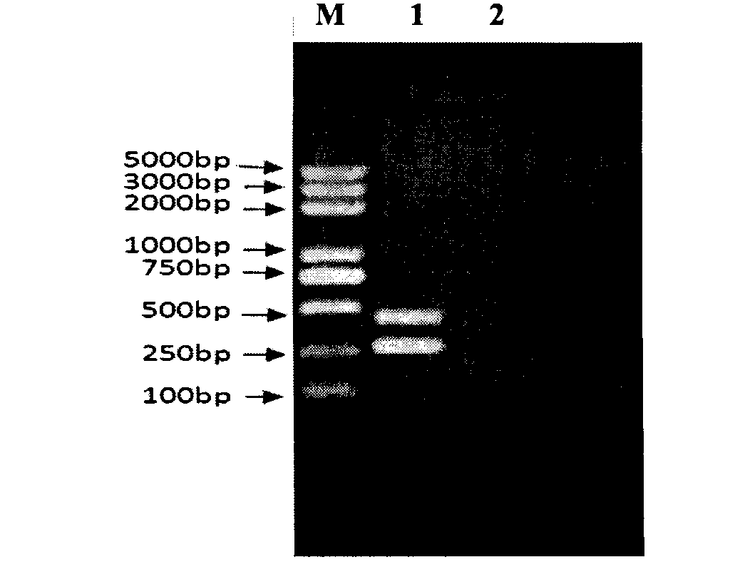 RT-PCR (Reverse Transcription-Polymerase Chain Reaction) discrimination and detection method of virulent classical swine fever virus (CSFV) Shimen strain and attenuated vaccine C strain