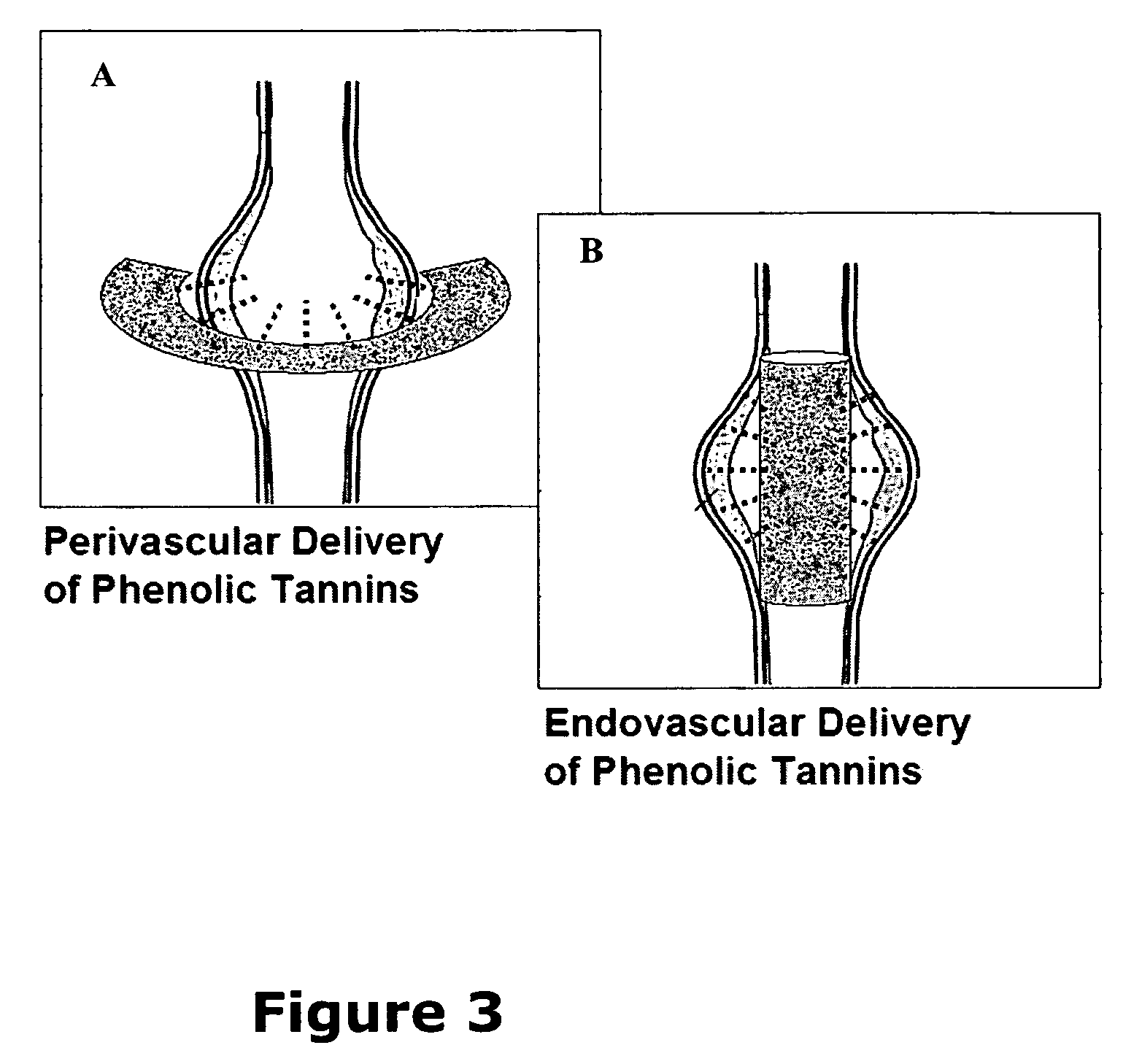 Elastin stabilization of connective tissue