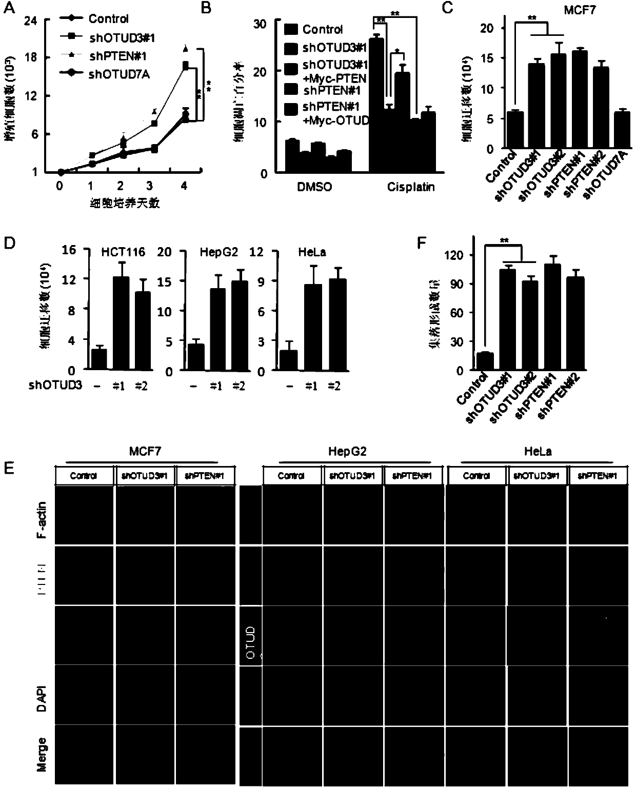 OTUD3-E86K protein as well as coding gene and application thereof